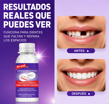 🦷 ¿Te falta un diente y quieres sonreír con confianza?
